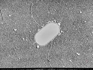 E.coli E.coli
